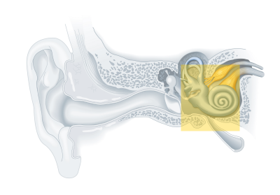 Tipos de tratamientos de pérdida auditiva
